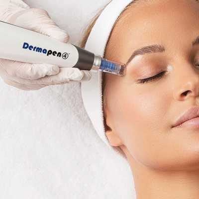 dermapen