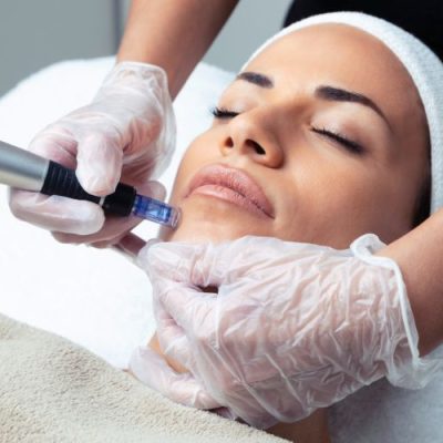 dermapen dermapen