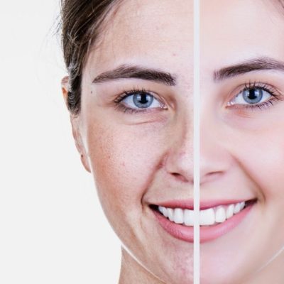 tratamiento-antiaging